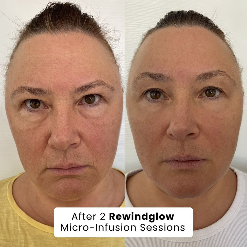 Best my skin has looked in years!